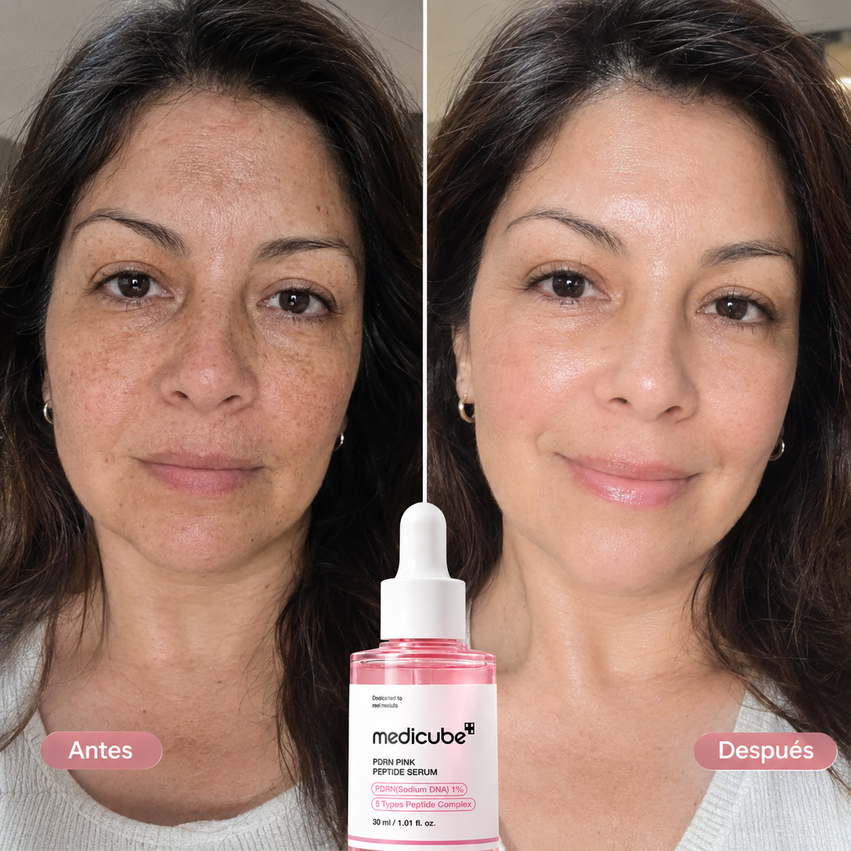 Medicube Pink Pdrn Peptide Serum 30ml: Repara, reafirma y da brillo natural.
